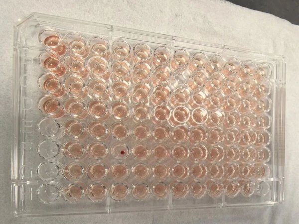 配资咨询平台 首例！广东顺德发现一例“钻石血”，比“熊猫血”罕见百倍